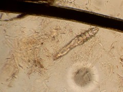 Imagen de microscopio Citología cutánea. ACARO DEMODEX. Sarna demodécica del perro